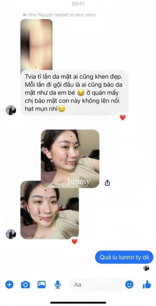 feedback trị mụn jimmy