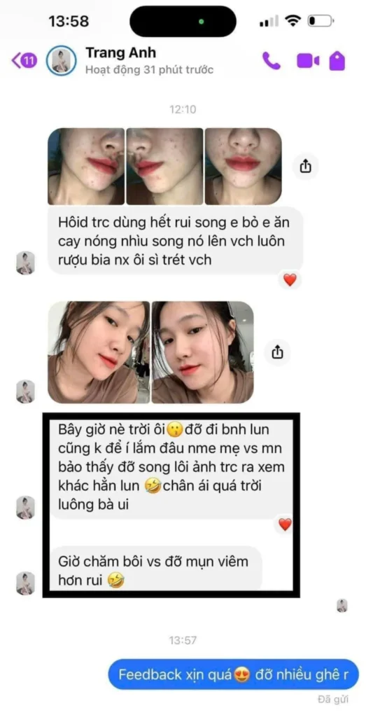 feedback-trị-mụn-jimmy